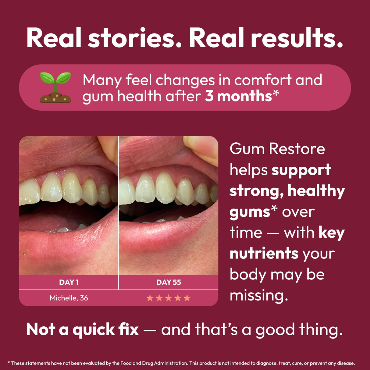 Strong Jaw Gum Restore - Gum Care + Teeth Vitamins - Gum Health & Oral Health - Supports Receding Gums & Gum Care - Dental Vitamins for Adults – 180 Capsules, Non-GMO Gum Health Supplements