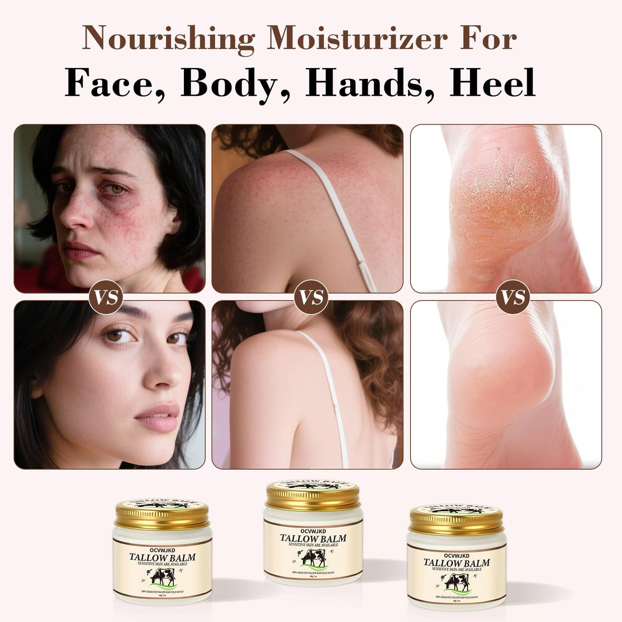 OCVWJKD Beef Tallow & Honey Balm, Beef Tallow for Skin, All-Natural Moisturizer Hydrates and Nourishes the Skin, Grass-Fed Beef Tallow & Raw Wild Honey Blend, Body & Face Moisturizer (6 Oz)