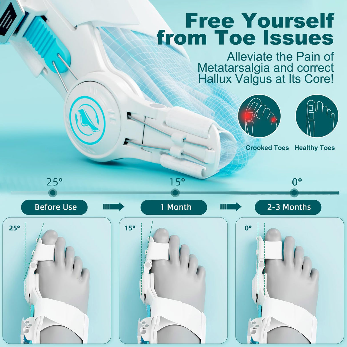 Kutain Upgraded Bunion Corrector for Women & Men, Orthopedic Bunions Correction with Non Slip Big Toe Straighteners, Adjustable Bunion Splint Suitable for Day/Night Feet Bunion Relief (2PCS)
