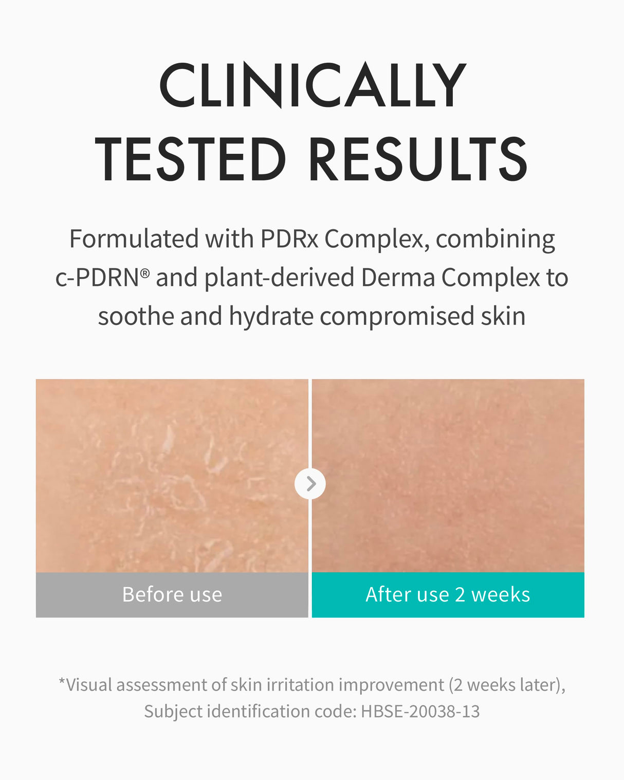 REJURAN® Moisture Cream, c-PDRN® - Daily Moisturizer for Long-Lasting Hydration and Skin Barrier Support with PDRx. (2.11 oz)