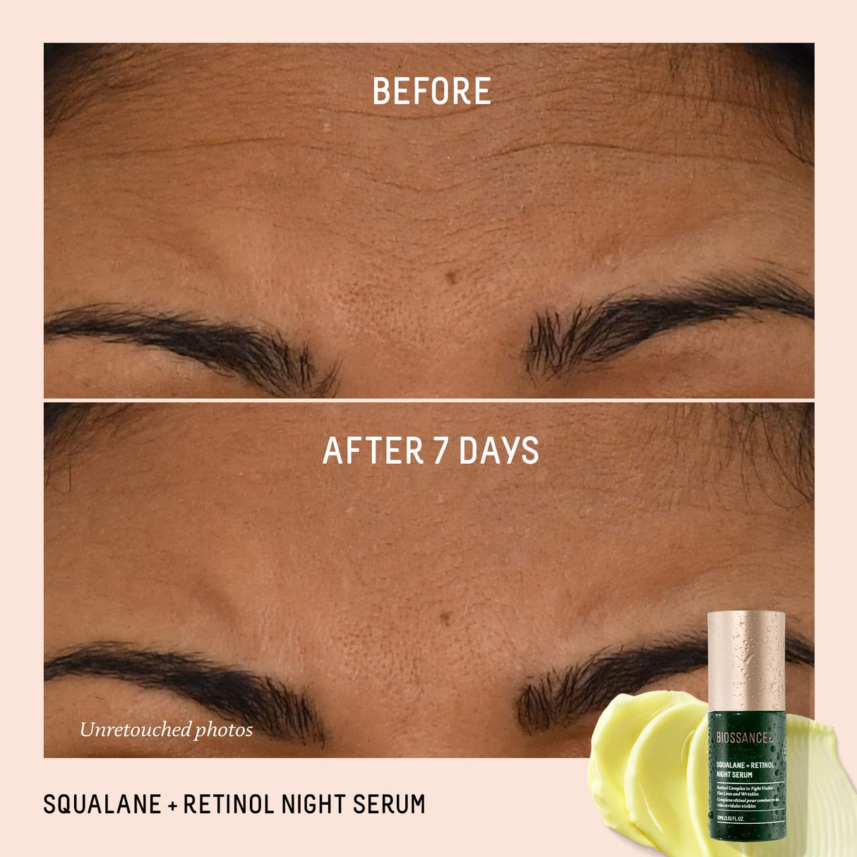 Biossance Squalane + Retinol Serum. Encapsulated Time-Release Retinol to Reduce Fine, Lines, Wrinkles, Discoloration and Texture. Cell Turnover with Minimal Irritation (1.01 fl oz)