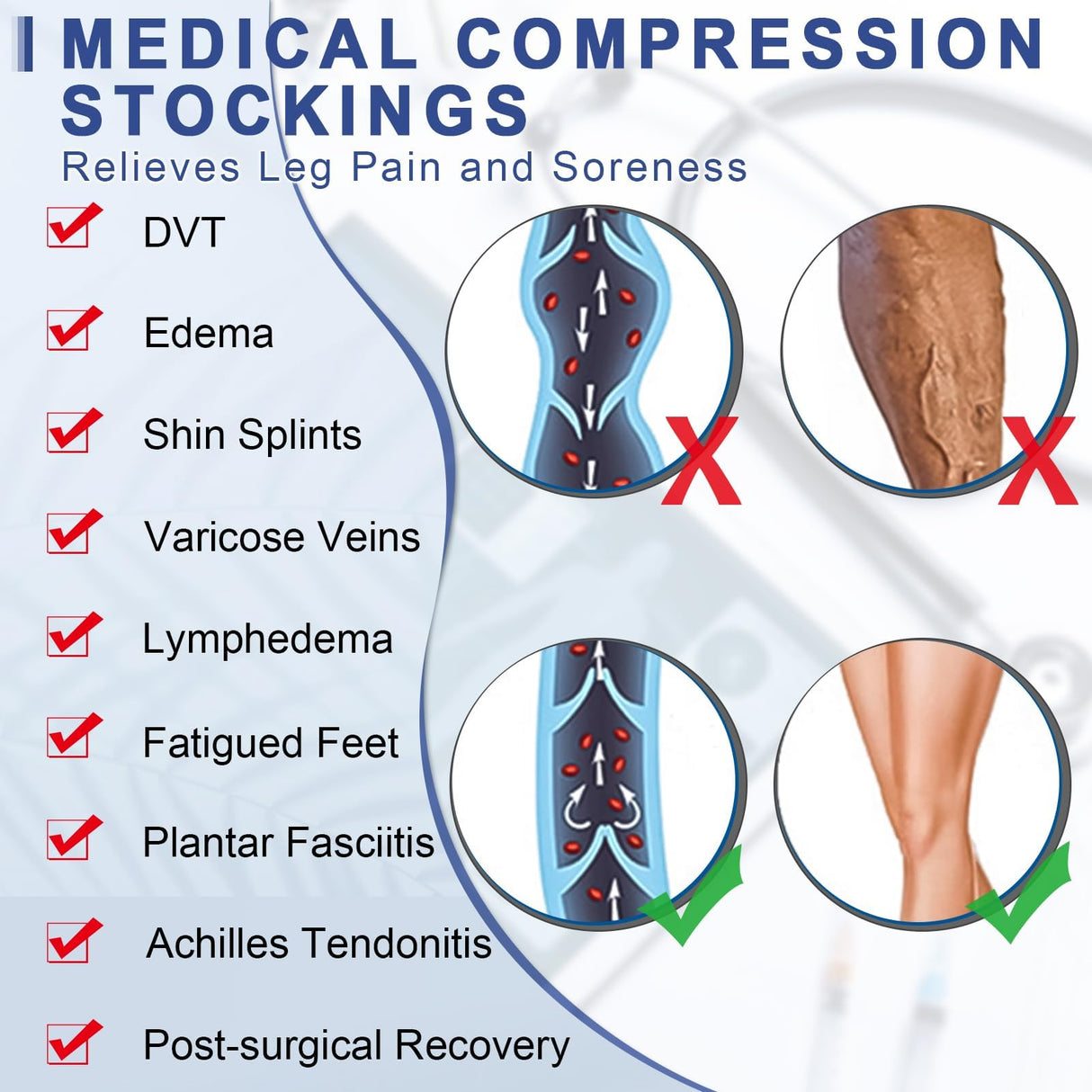 Beister 1 Pair Medical Open Toe Thigh High Compression Stockings with Silicone Band for Women & Men, Firm 20-30 mmHg Graduated Support for Varicose Veins, Edema, Flight.