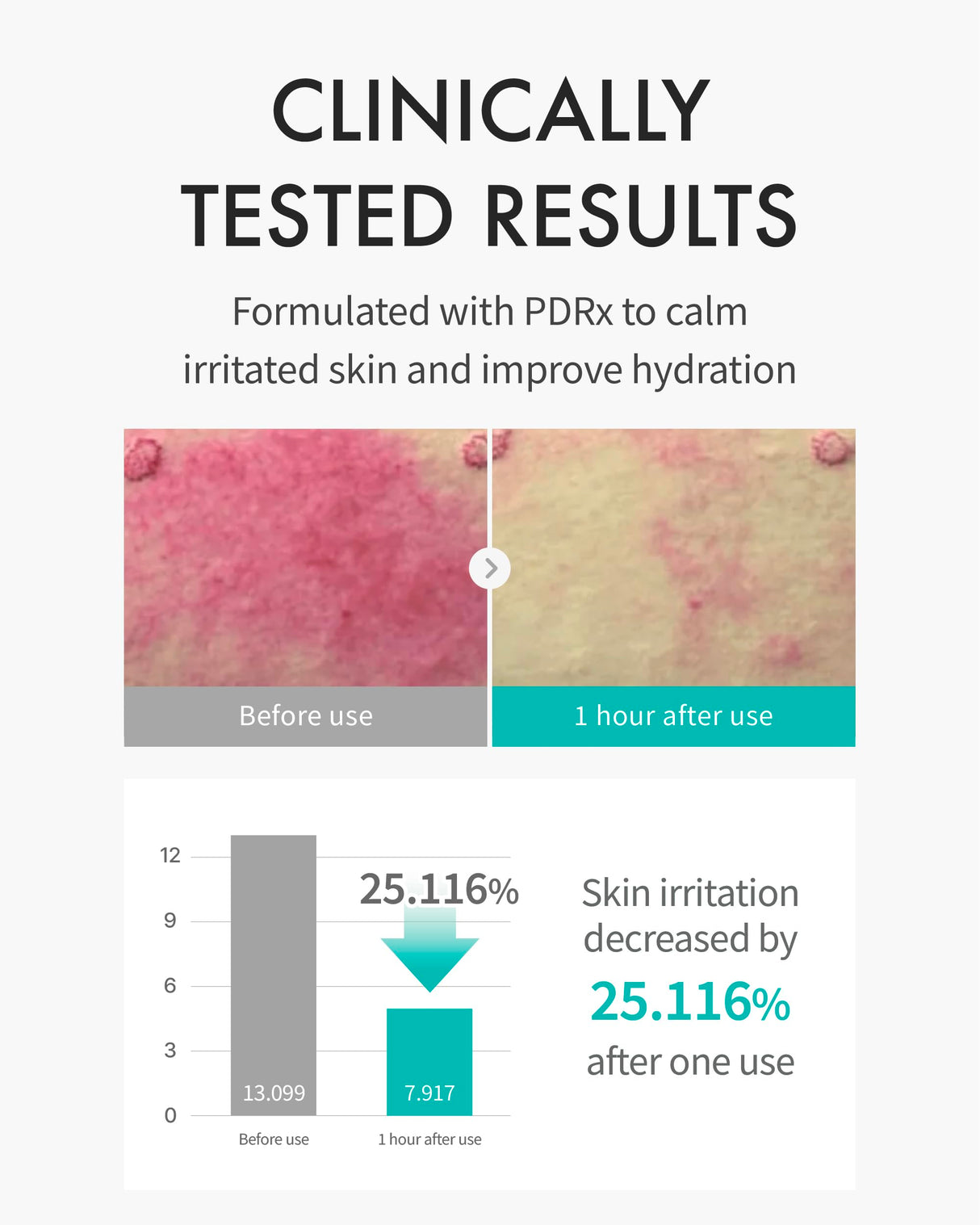 REJURAN® Moisture Treatment Mask, c-PDRN® - Hydrating Facial Sheet Mask, Repairs Skin Barrier and Retains Moisture with PDRx, Korean Skin Care 5-Pack