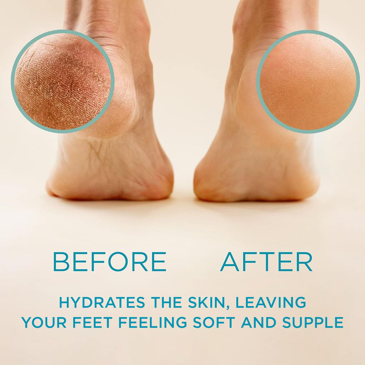 Lee Beauty Professional Callus Remover for Feet - Original, Powerful Formulation - Extra Strength Gel, Home Pedicure Foot Spa Results - Cracked & Dead Dry Skin Supplies - 8 Oz, Pack of 2