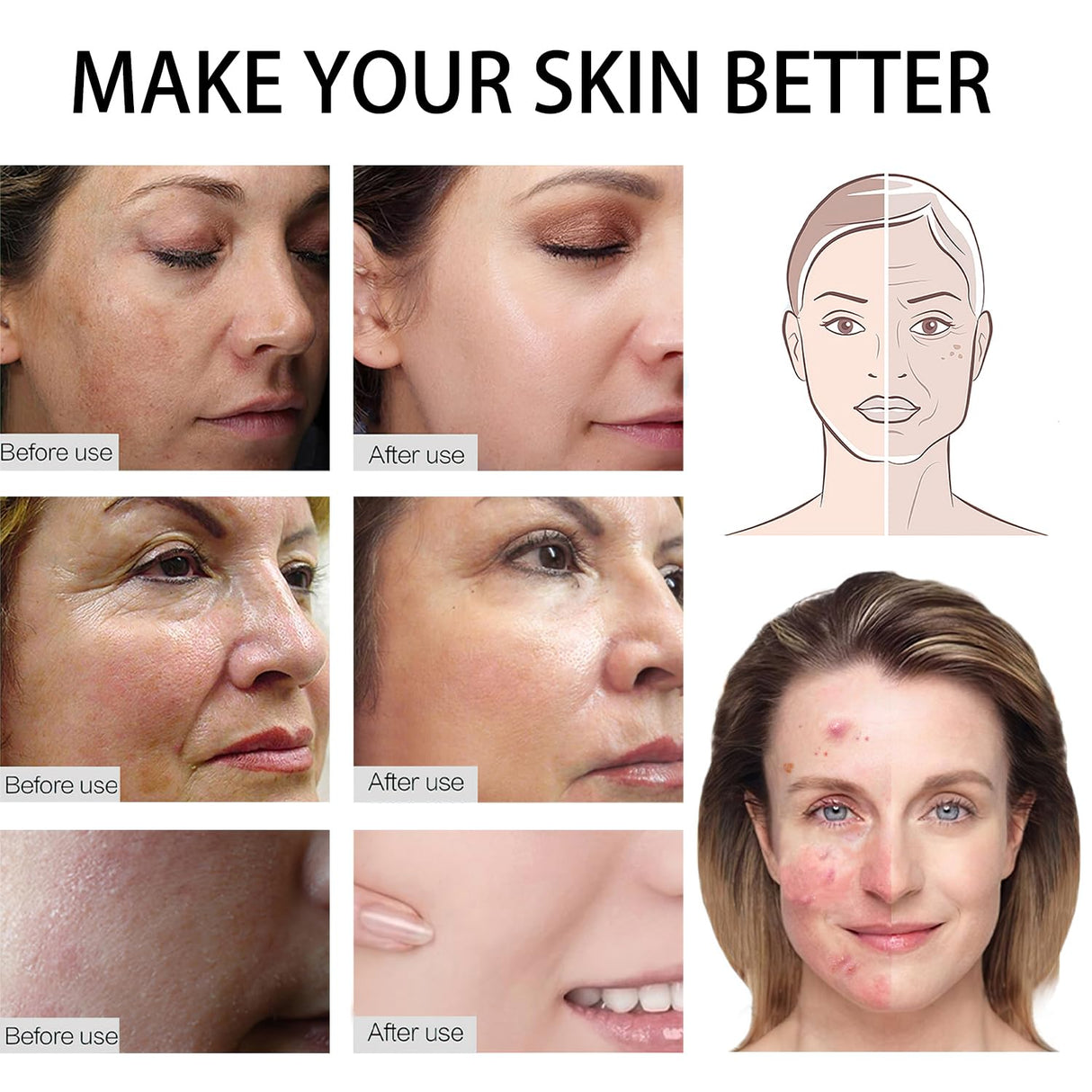 Home Use 0.25mm Beauty,Derma Roller kit- 0.25 mm