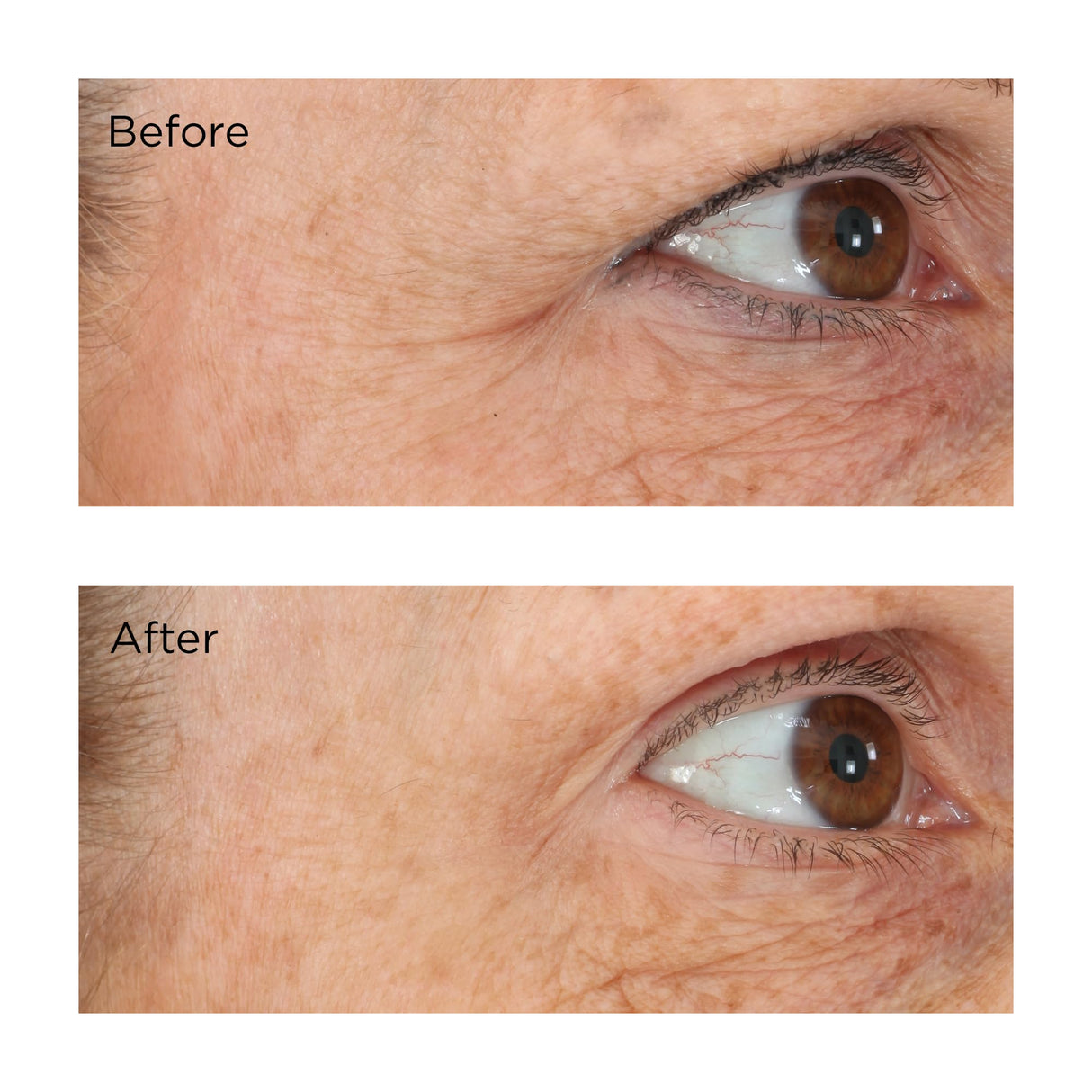 Essential Fx Acyl-Glutathione Eyelid Lift Serum, 0.5 fl. oz.