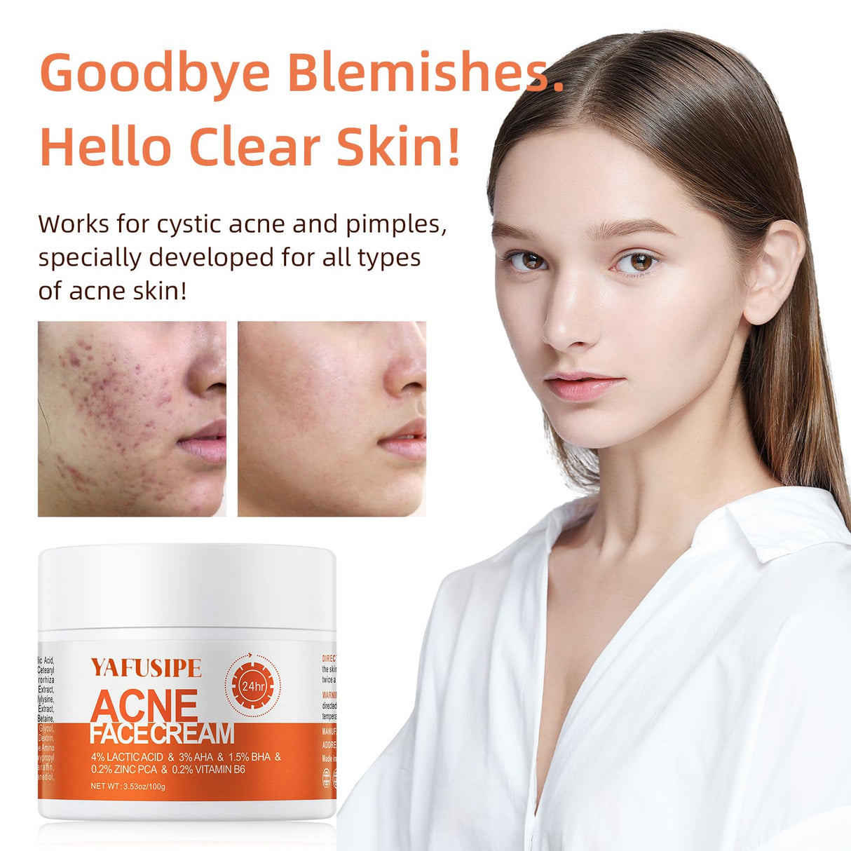 Acne Treatment for Face for Hormonal Cystic Stubborn Acne Cream for Sensitive Skin Teens Adults Women Men Spot Pimple Butt Control Rapid Clearing Breakout Overnight Face Blemish Treatment Moisturizer