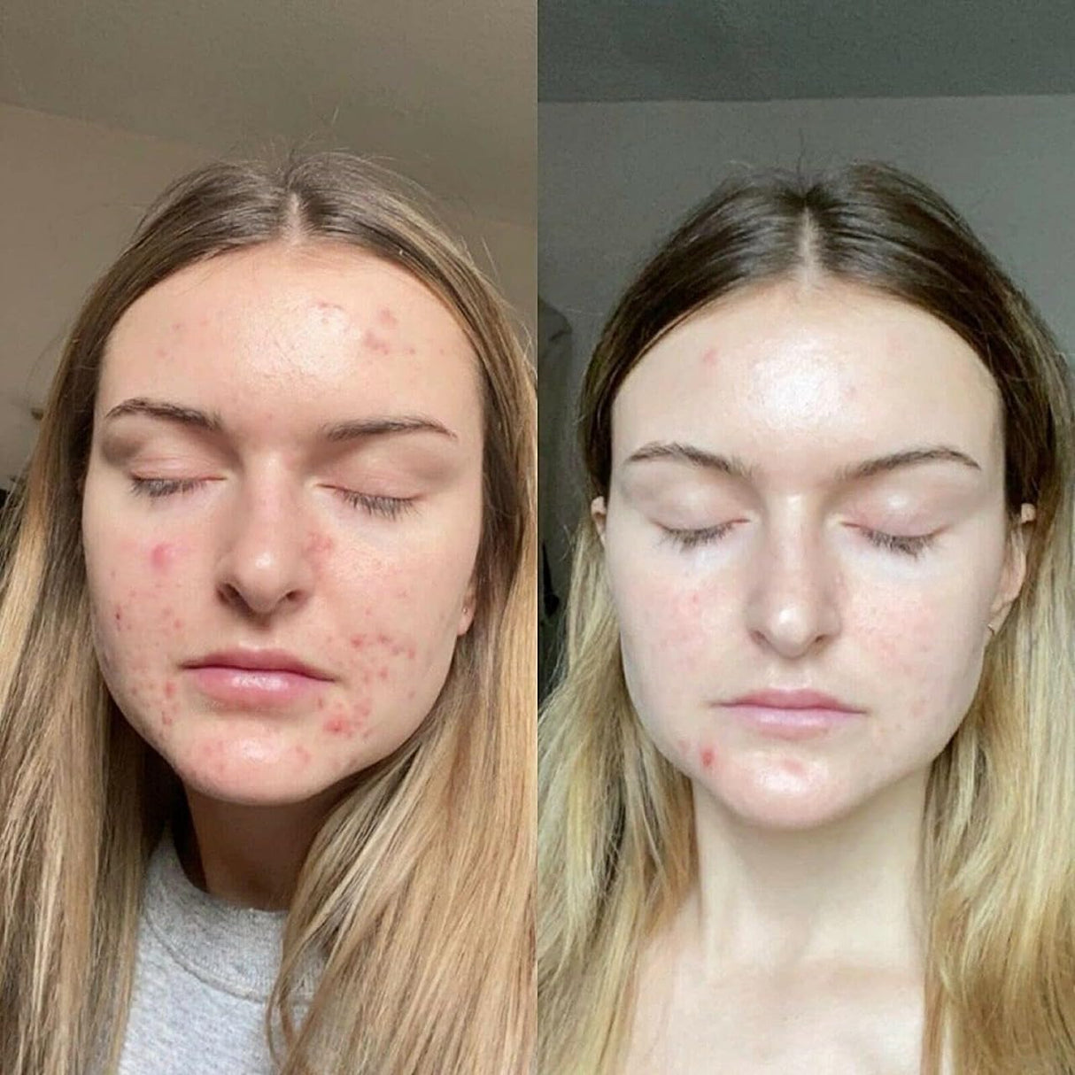 Retinol Gel 0.1 Vitamin A Repairs Fine Lines & Wrinkles, Scar Treatment, Age and Sun Spots, Anti-Aging Formula Gel 20 Grams