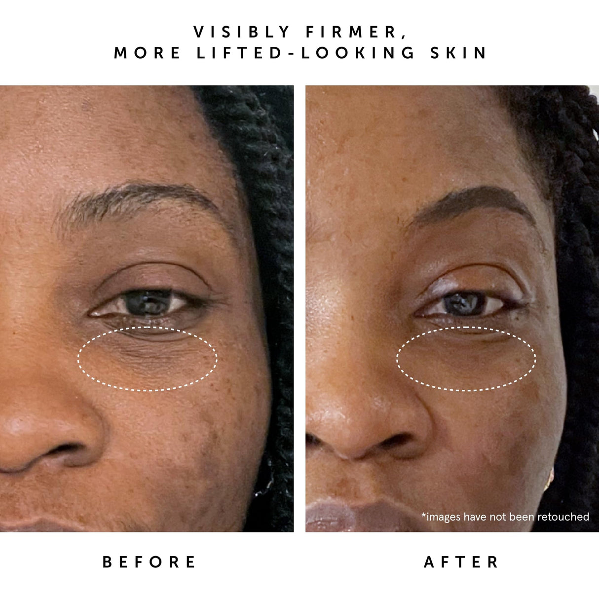 HERBIVORE Bakuchiol Retinol Alternative Moon Fruit Face Serum EXTRA STRENGTH – 1% Bakuchiol + Peptides, Smooths Skin, Reduces Fine Lines & Wrinkles, Plant-based, Vegan, Cruelty-free, 30mL / 1 oz