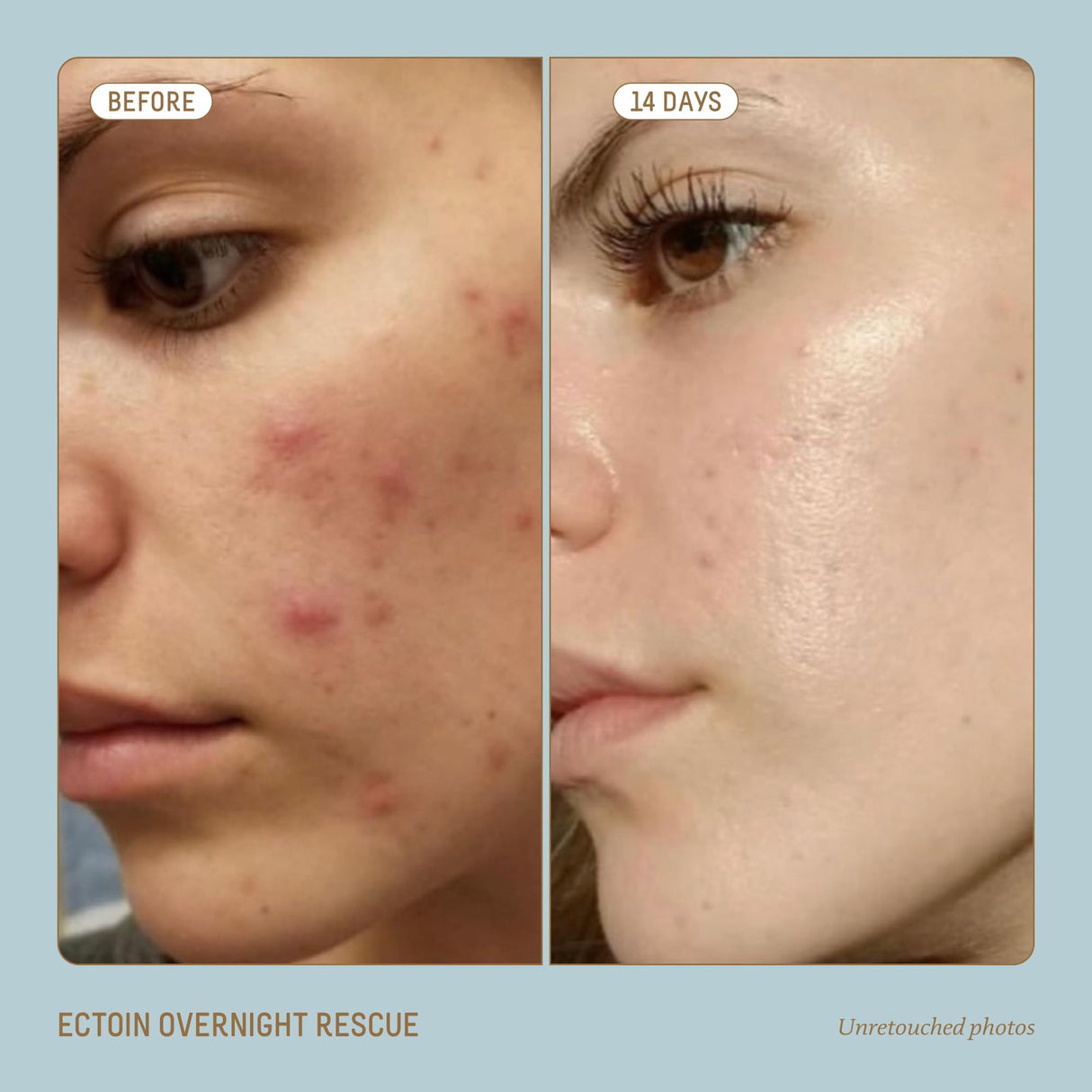 BIOSSANCE Squalane + Ectoin Overnight Rescue, hydrating, Firming and Smoothing Skin Care Treatment, 1.6oz