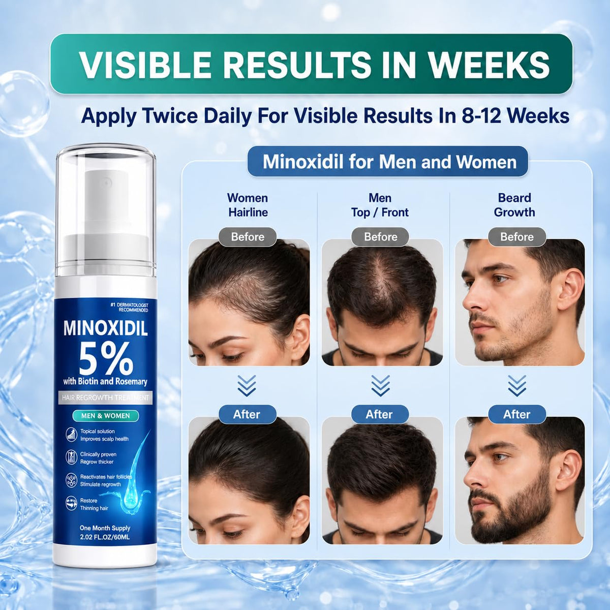 Minoxidil for Men and Women, Hair Growth Serum with Biotin, Rosemary and Batana for Hair Beard Regrowth Treatments Extra Strength Hair Loss Solution, Clinically Proven to Regrow Thicker, 60ML