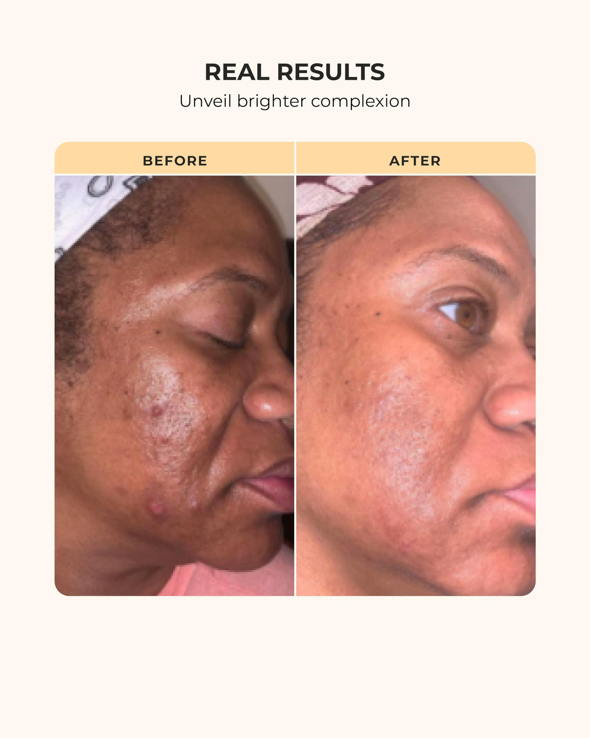 Buttah Skin by Dorion Renaud Complete Melanin-Rich Skin Care Kit | Shea Butter, Vitamin C Serum, Facial Cleanser | Organic & Natural | Black-Owned