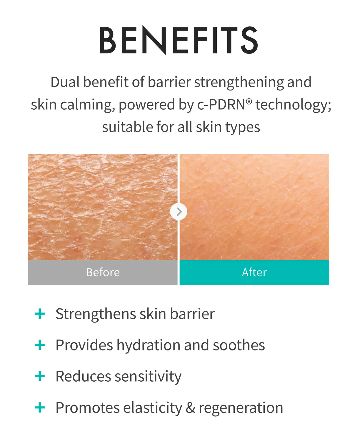 REJURAN® Turnover Cream, c-PDRN® - Daily Moisturizer for Dual-Revitalizing Effects. Soothing and Skin Barrier Strengthening for Clear, Healthy Skin. Korean Skin Care. (1.69 fl oz)