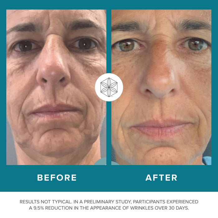 Isagenix Collagen Elixir - Collagen Drink with Marine Collagen Peptides - Liquid Collagen Shot to Support a Youthful Appearance with Vitamin C, Zinc & Biotin - 50 mL