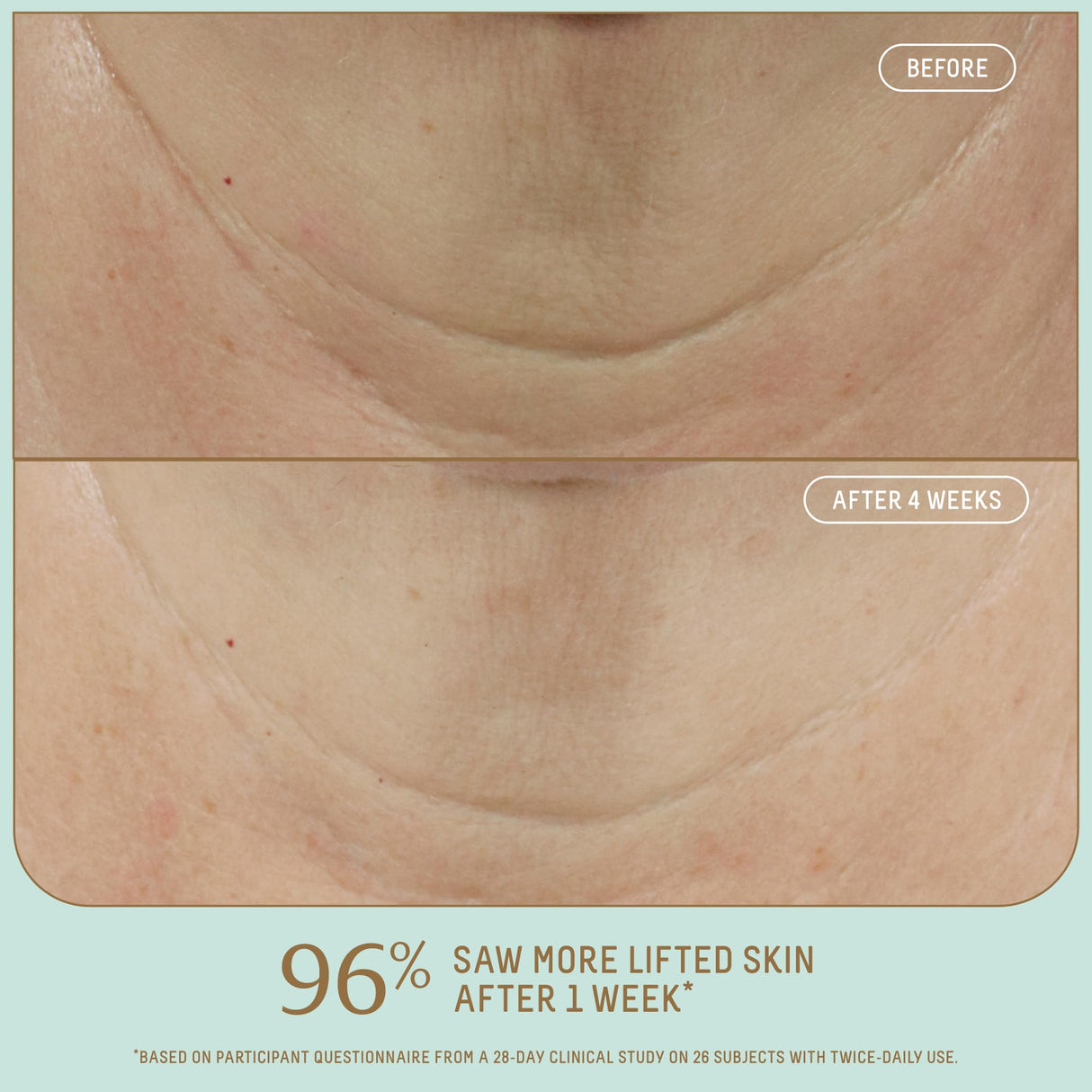 Biossance Squalane + Firm & Lift Dual Serum – Face Serum for Maturing Skin – Lifts & Hydrates – Reduces Wrinkles – Hyaluronic Acid, Squalane, Ectoin, Gravetye Giant & Bisabolol – 30ml