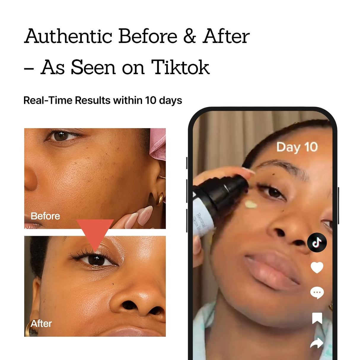 MEDITHERAPY Retinal Skin Booster Serum 5.07 Fl. Oz for Beginner & Sensitive Skin - Advanced Retinol Serum for Face and Body - Vegan Retinaldehyde Facial Serum for Uneven Skin Tone & Fine Lines