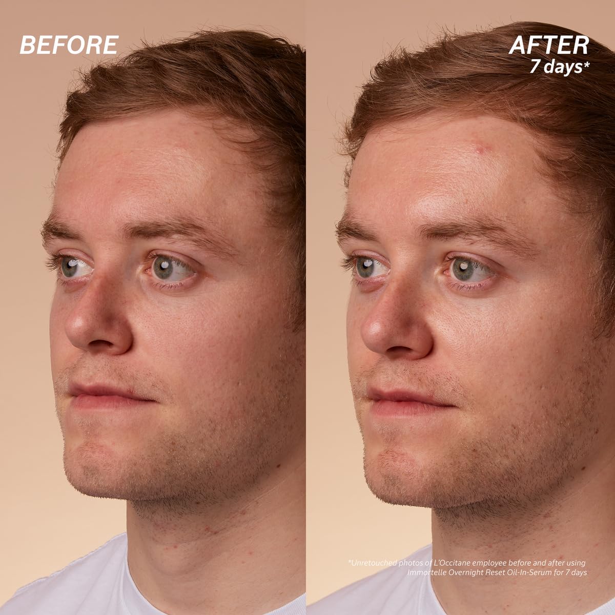 L'Occitane Immortelle Overnight Reset Oil-in-Serum 1.00 fl. oz