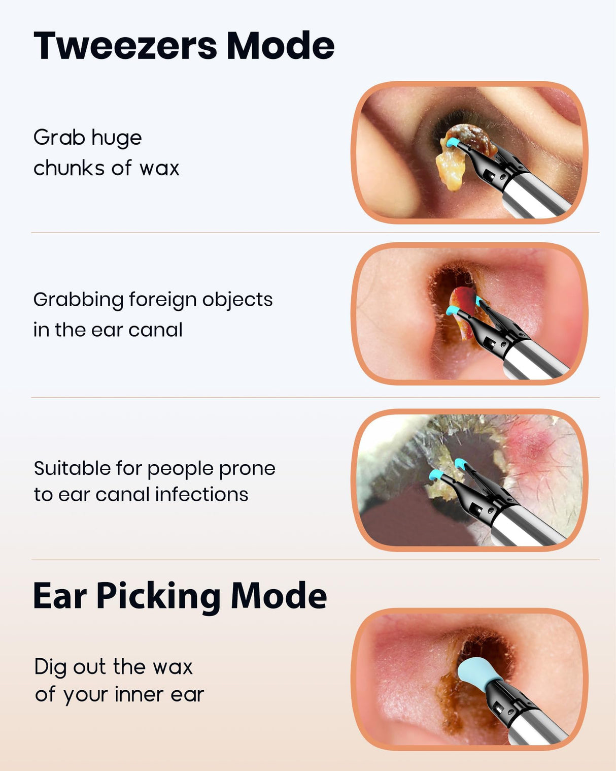 BEBIRD Note 5 Pro Ear Canal Cleaner: FHD Camera with Omnidirectional Tweezers, IoT-Enabled Otoscope Support Remote Videos, Magnetic On/Off Cap, Ear Hygiene StorageBase