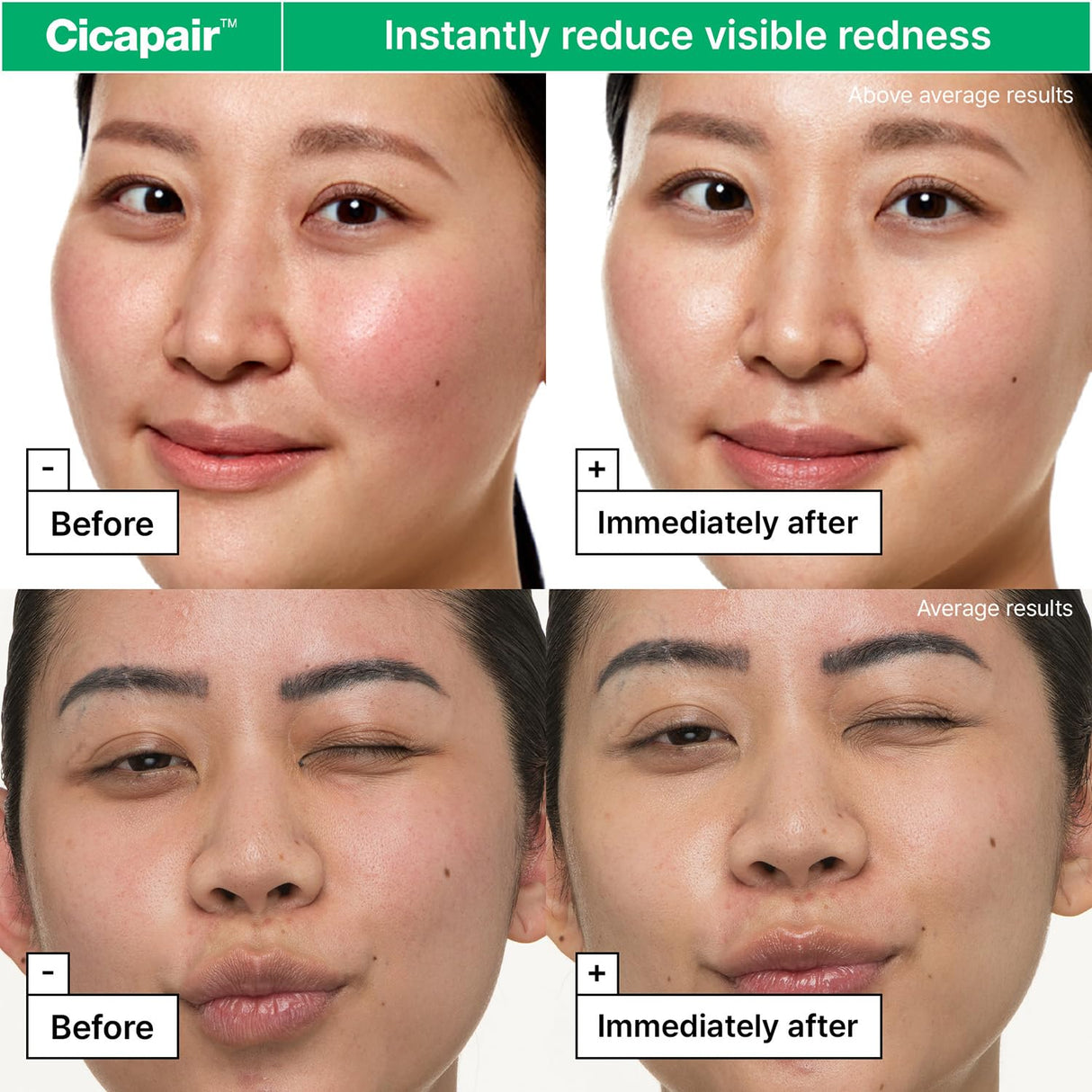 Dr.Jart+ Cicapair™ Sensitive Skin Face Moisturizer for Redness and Barrier Repair with Centella Asiatica | Korean Skin Care, 1.69 Fl Oz