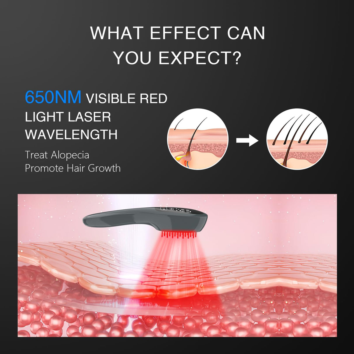 Jitesy Laser Therapy Hair Growth Comb, Red Light Therapy for Hair Growth, FDA Cleared Laser Comb System, Hair Loss, Hair Thinning & Alopecia Treatment for Men & Women Homeuse