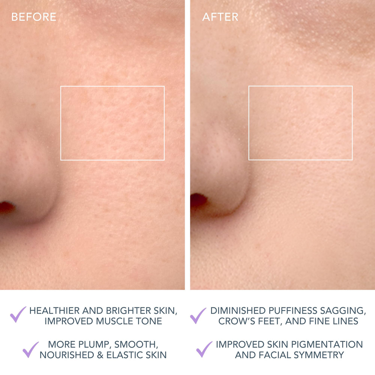 FOREO LUNA 4 Face Cleansing Brush - Firming Face Massager - Anti Aging Care - Enhances Absorption - Simple Skin Care Tools - Sensitive Skin