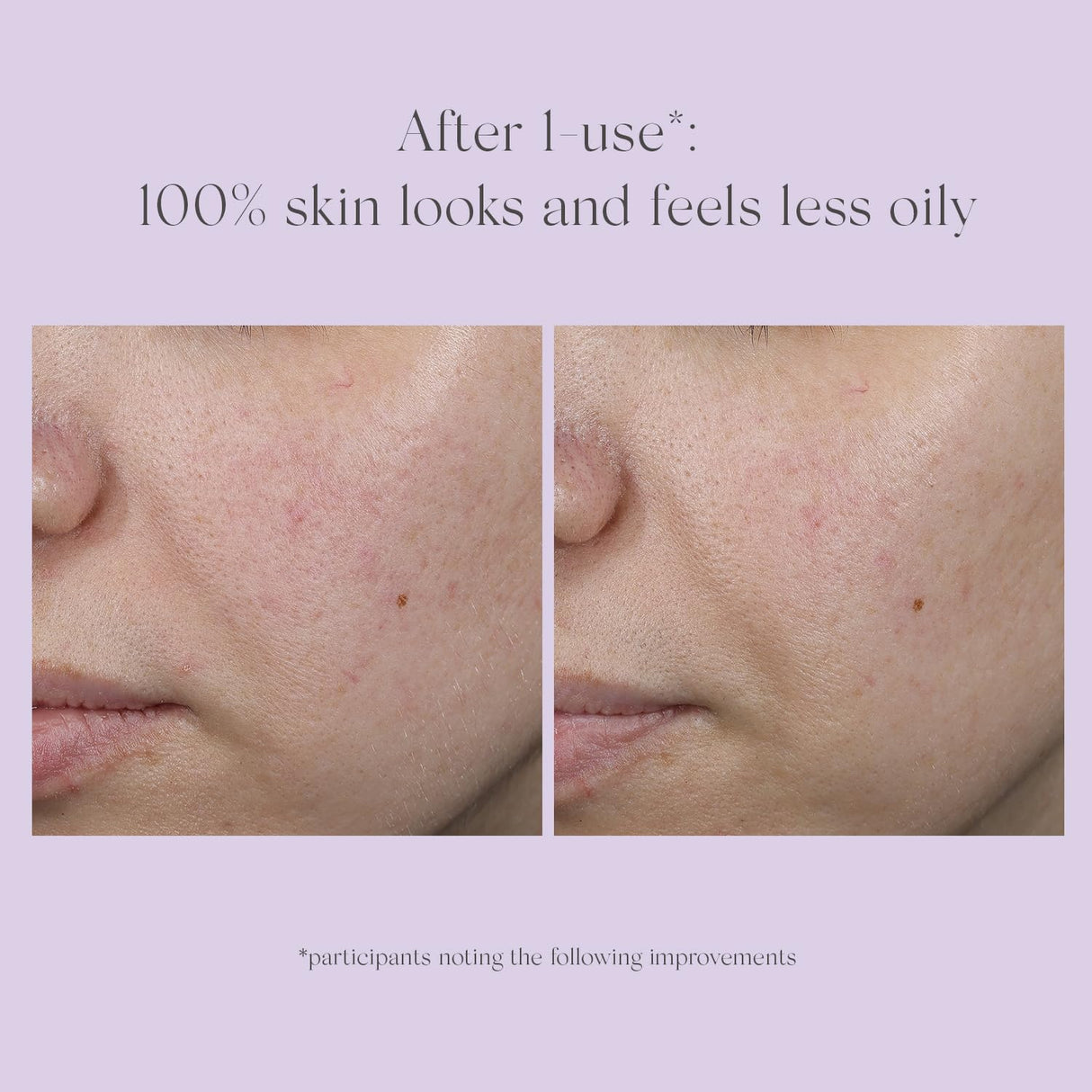 EXUVIANCE Performance Peel AP25 At-Home Chemical Peel with Glycolic, Mandelic and Polyhydroxy Acids, 13 ct.