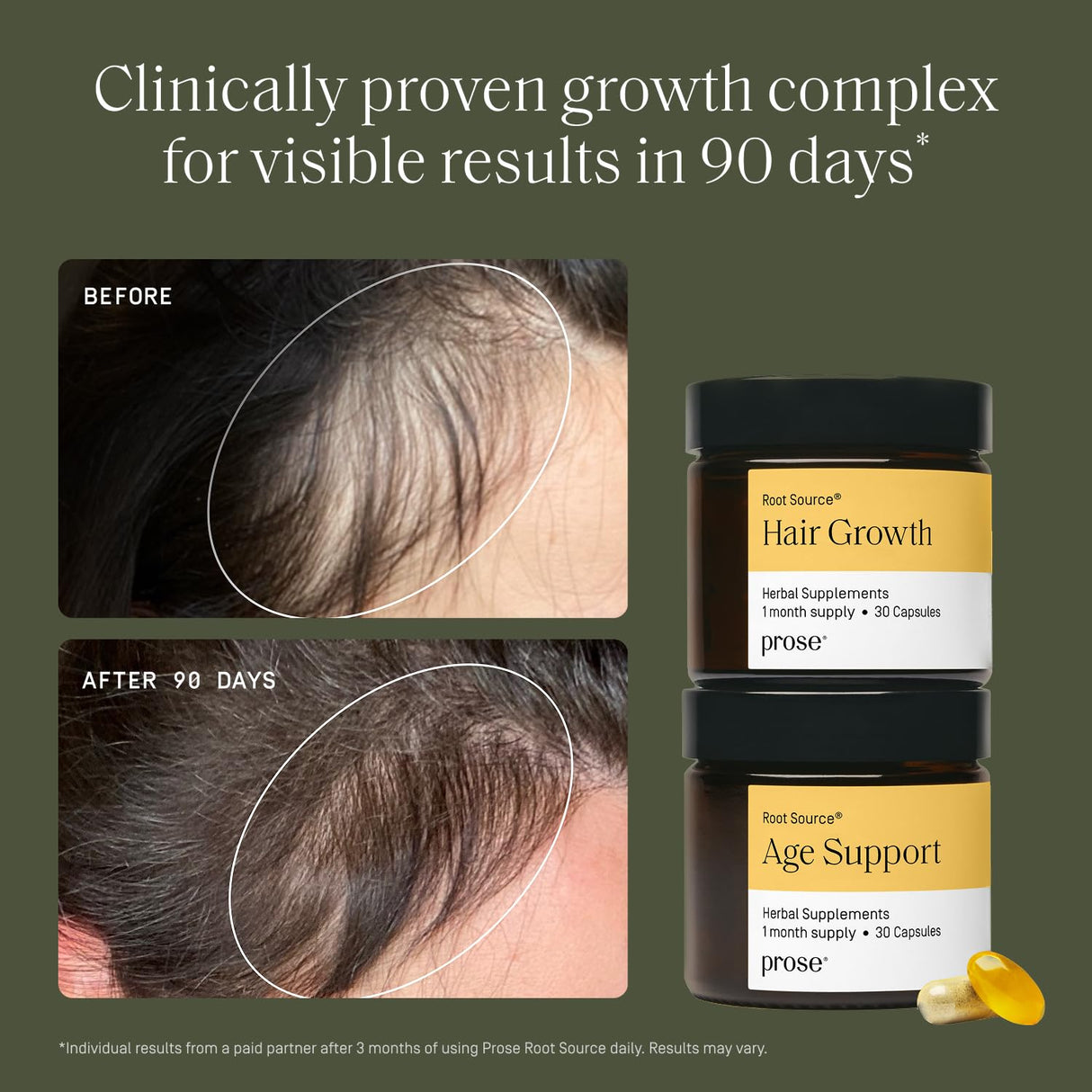 Prose Women's Hair Growth & Age Support Supplements, Root Source® Boosted with Biotin, Clinically Proven Growth Complex for Visibly Fuller Hair in 90 Days, 30 Day Supply (2 Daily Capsules)