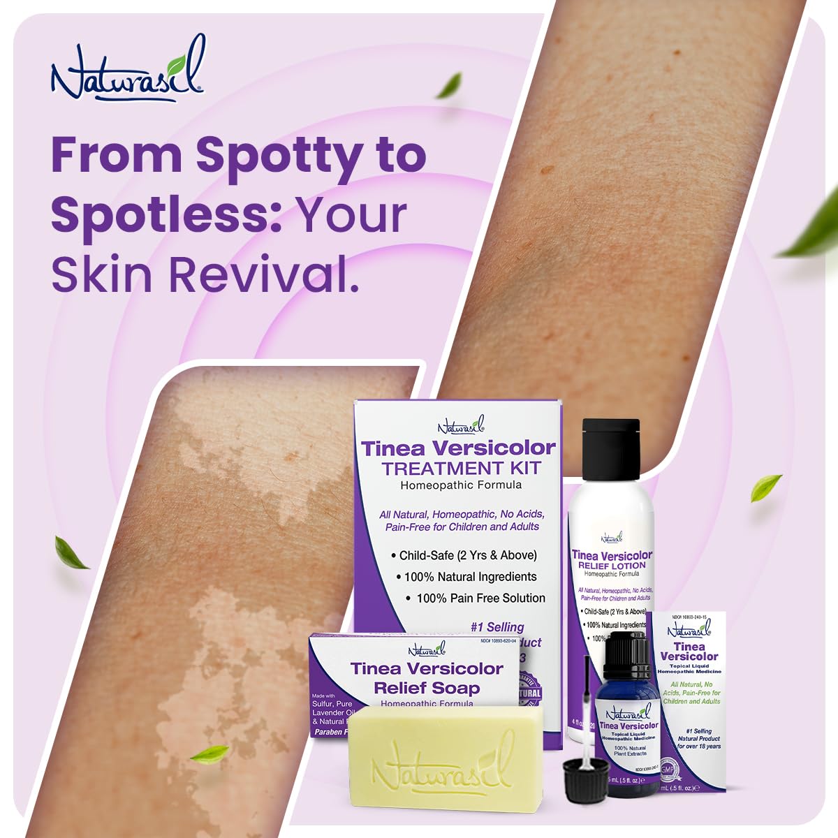 Naturasil Tinea Versicolor Treatment +2 Bars | Max-Strength 10x Soap | Antifungal Micronized Sulfur | Stops Pityriasis, Candida, Ringworm & Irritation | Fast Acting Adult & Kid Safe | 4 oz (2 Pack)