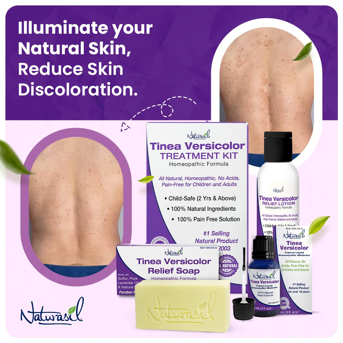 Naturasil Tinea Versicolor Treatment +2 Bars | Max-Strength 10x Soap | Antifungal Micronized Sulfur | Stops Pityriasis, Candida, Ringworm & Irritation | Fast Acting Adult & Kid Safe | 4 oz (2 Pack)