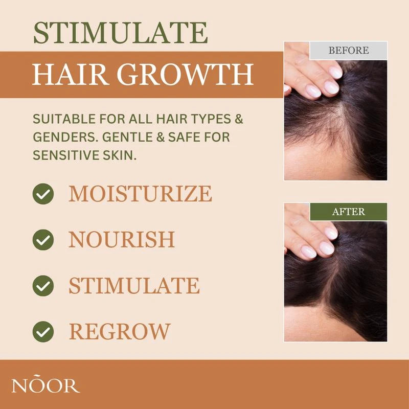 Noor Hair Rosemary Growth Spray - Hair Growth with Rosemary, Green coffee bean, Biotin, Cynatine Keratin, and MCT Oil from Palm Leaves - Thicker Hair - Scalp Itchiness Relief - 2 FL Haircare Nourishing