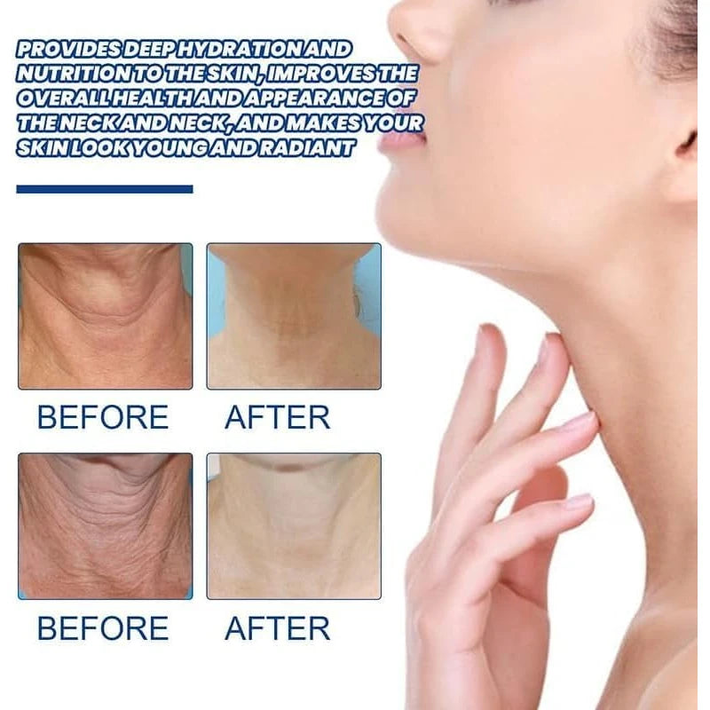 Tighten & Lift Firming Neck Cream, Uoohe Neck Cream, Anti-Aging Neck Cream For Women, Anti Wrinkle Moisturizing Neck Cream For Women(2PC)