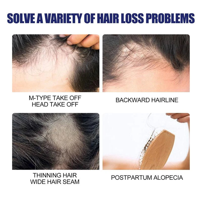 East Moon Men'S Hair Thickening Foam | Plant-Based Formula For Stronger Strands & Scalp Nourishment