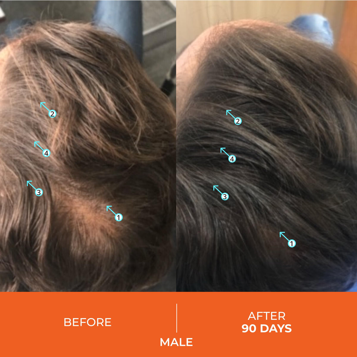 DS Labs Revita Shampoo and Conditioner – High-Performance Hair Density Kit, Volumizing, Thickening, Fuller, Sulfate & Silicone Free, For Men & Women, 925mL, Packaging May Vary