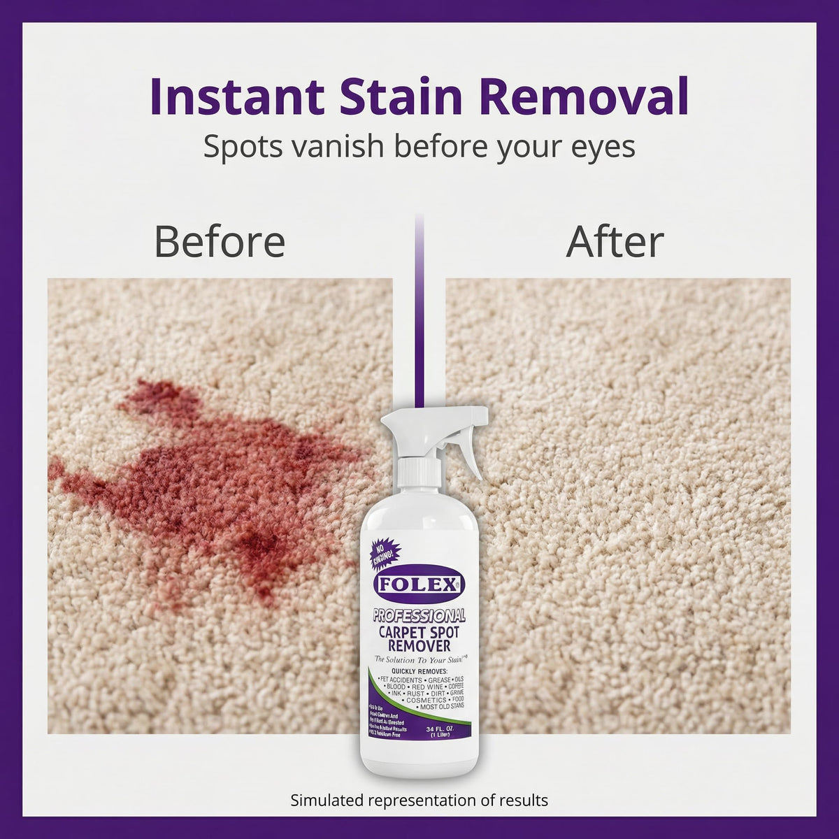 FOLEX Professional Carpet Stain Remover Spray – Stain Remover for Old Stains – Best Remover for Pets – Rug Stain Remover & Upholstery Cleaner – Cleaner Solution for Couches & Car Interiors – 34 oz