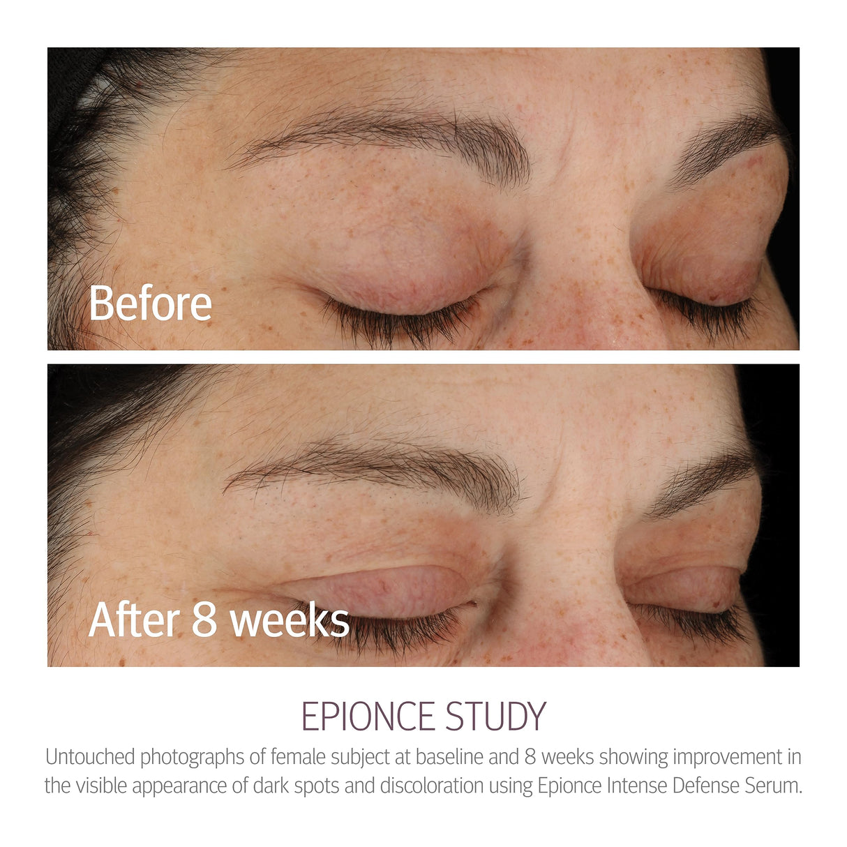 Epionce Intense Defense Serum - Anti-Aging Facial Serum with Vitamin C, Vitamin E, Vitamin D, A, B, & Niacinamide, Dermatologist Skincare