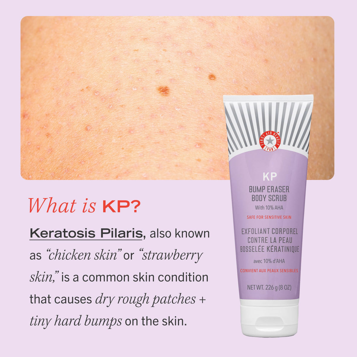 First Aid Beauty - KP Bump Eraser Body Scrub with 10% AHA, Keratosis Pilaris Skin Exfoliater with Glycolic and Lactic acids, Helps Reduce Chicken Skin Bumps, Safe for Sensitive Skin, 8 oz, 2ct