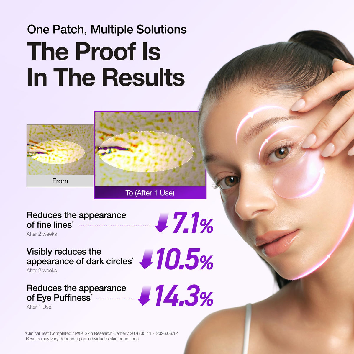 Anua Retinol Berry Eye Patches, 60 Count