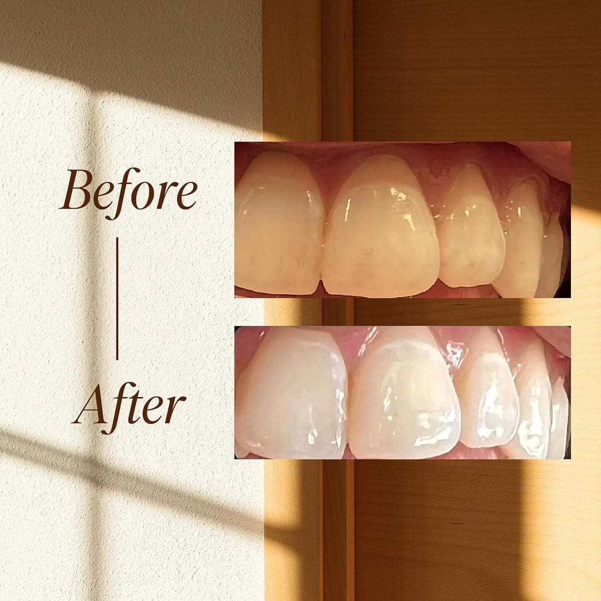 Boka Fluoride Free Toothpaste Nano Hydroxyapatite, Helps Remineralize, Appropriate for Sensitive Teeth, Whitening - for Adult, Kids Oral Care - Refresh Mint Flavor, 4 Fl Oz 3Pk