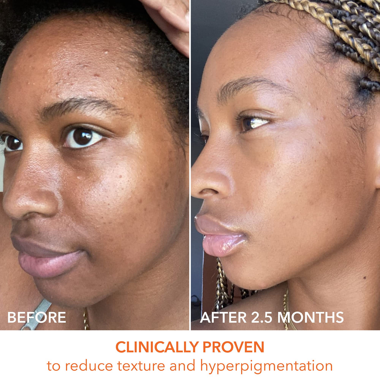 Dr. Dennis Gross Alpha Beta Universal Daily Peel 60 Treatments