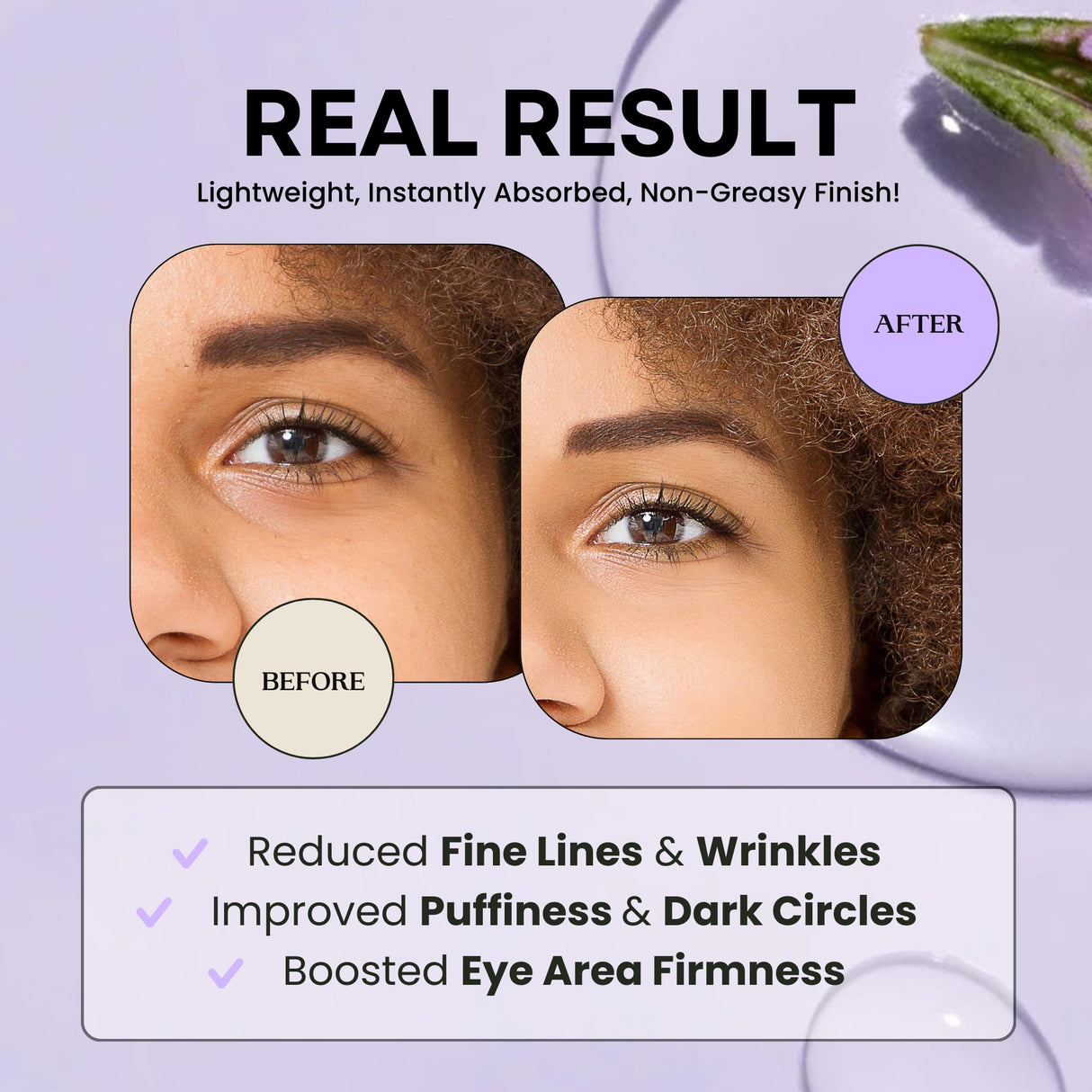 Excuse My Frank Bakuchiol Age Defense Eyecream, Korean Eye Cream, Gentle Cream, Natural Retinol, Dark Circles Puffiness & Firming, Anti Aging, Wrinkle Care, Fragrance Free, Vegan1.01fl oz