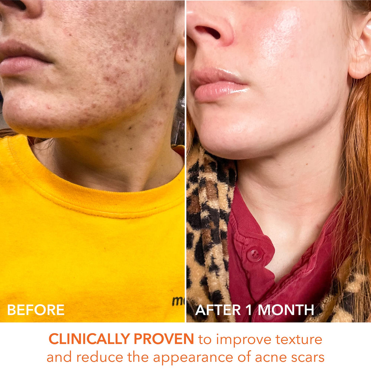 Dr. Dennis Gross Alpha Beta Universal Daily Peel 60 Treatments