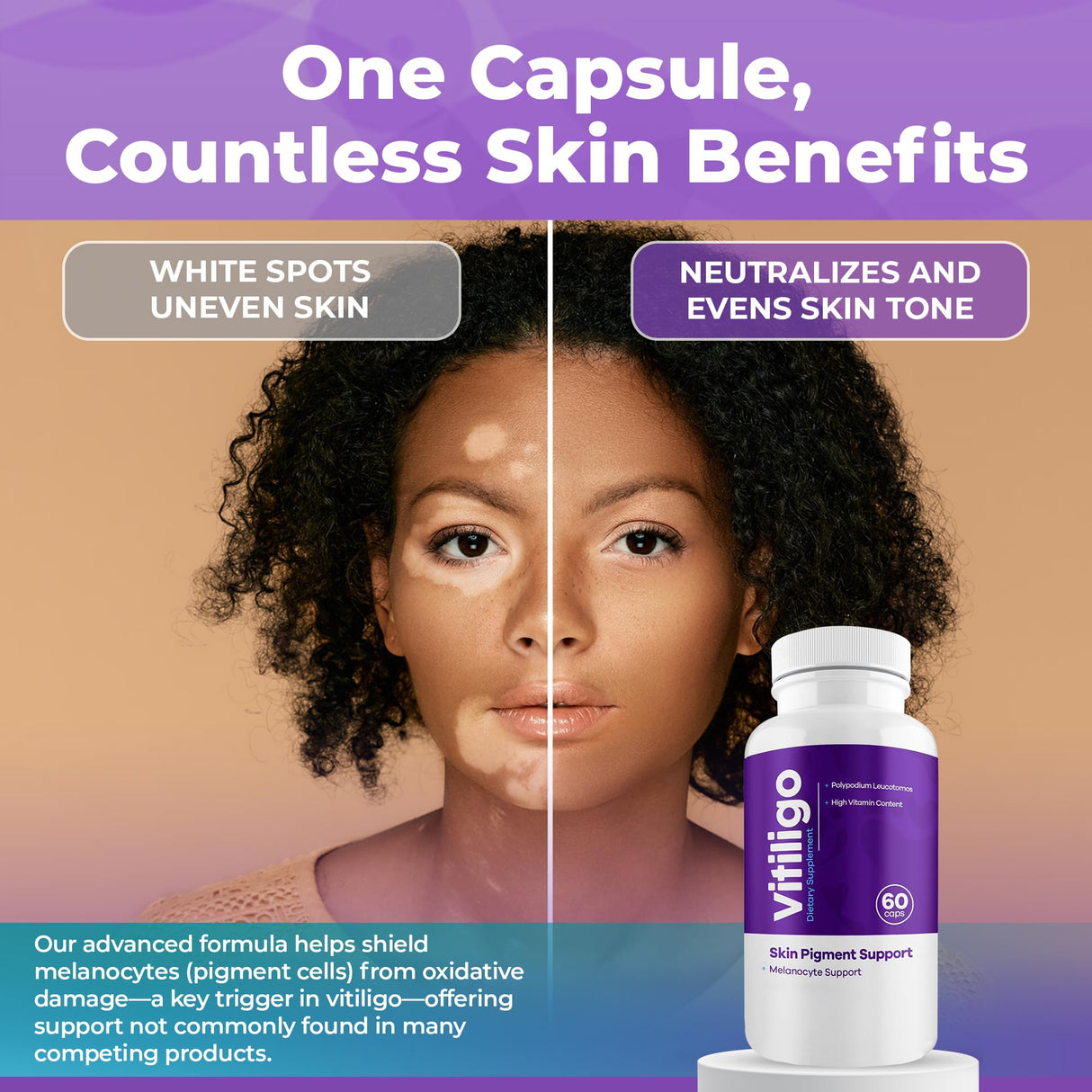 AURA VITAMINS - Vitiligo Capsules 60 Count | 1 Month | Improve Skin Pigmentation Support and Reduce White Spots | Effective Vitiligo Supplement | Natural Solution for White Spots on Skin. (3)