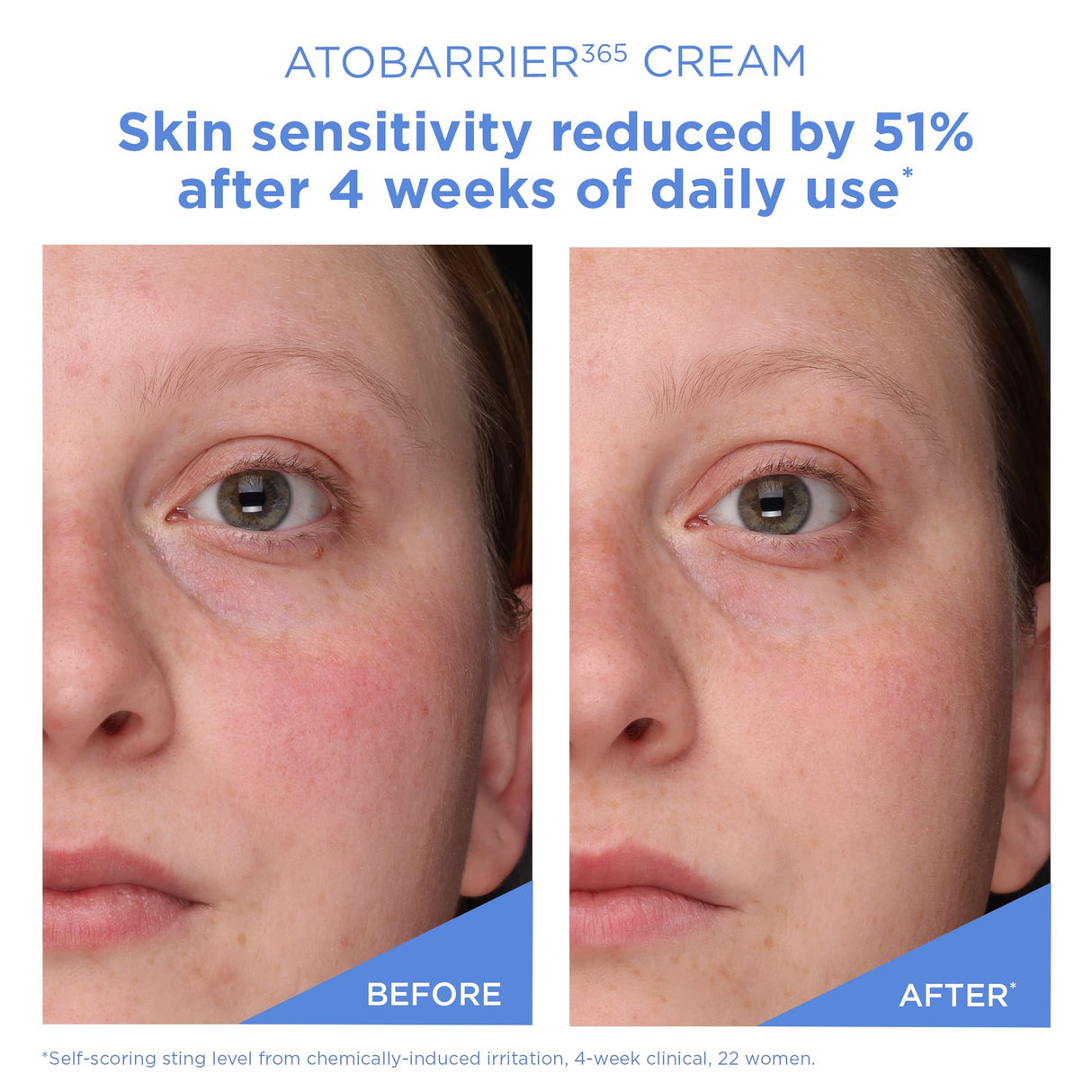 AESTURA ATOBARRIER365 Cream with Ceramides, Korean Moisturizer for Skin Barrier Repair | Long-lasting Hydration, Ceramide Capsules, Dry & Sensitive Skin, Non-comedogenic, 80 mL / 2.70 fl.oz.