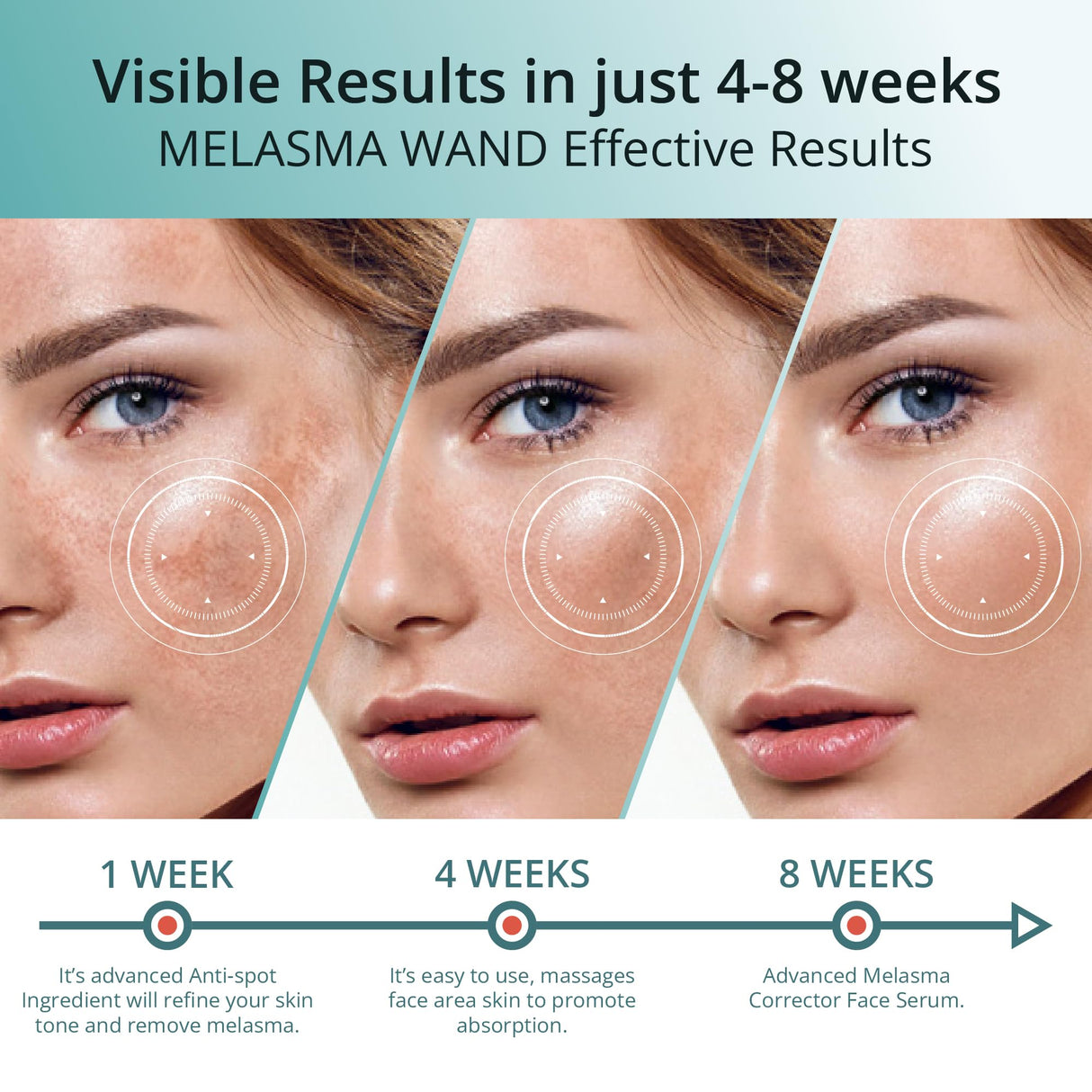 Abera Melasma Serum Plus, Melasma Treatment for Face, Dark Spot Corrector Serum, Melasma Dark Spot Remover, Sun Spot, Age Spot, Brown Spot Remover for Men, Women (1 FL OZ)