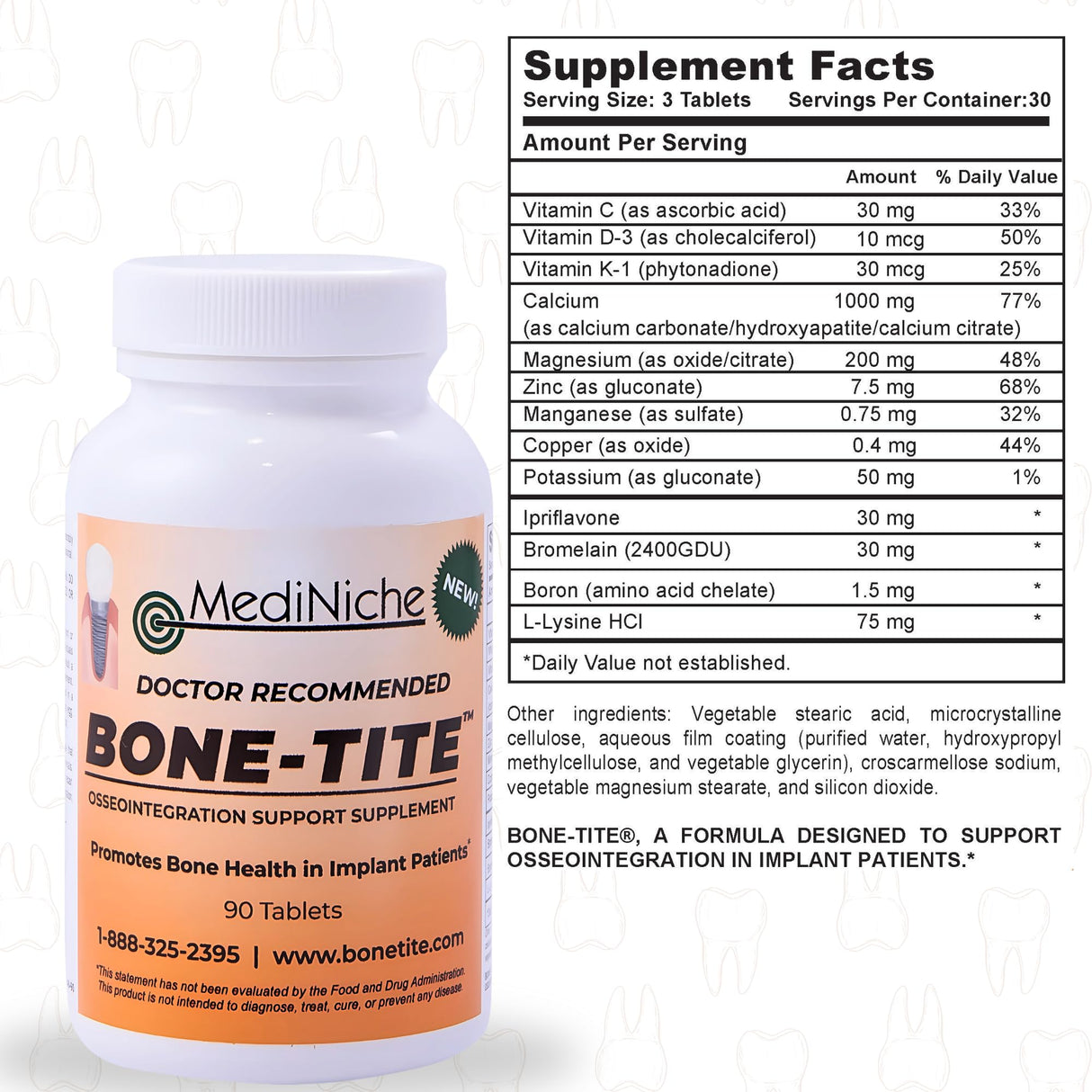 Bone-Tite Osseointegration Support Supplement I Key Vitamins, Minerals, and Nutrients to Promote Dental Implant Support | 90 Tablets | Pack of 1