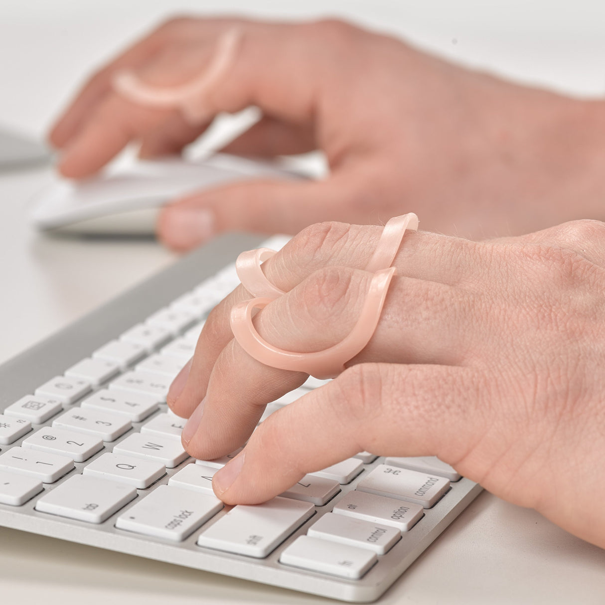 3-Point Products Oval-8 Finger Splints, Support and Protection for Arthritis, Trigger Finger or Thumb, and Other Finger Conditions Size 10 (Pack of 5)