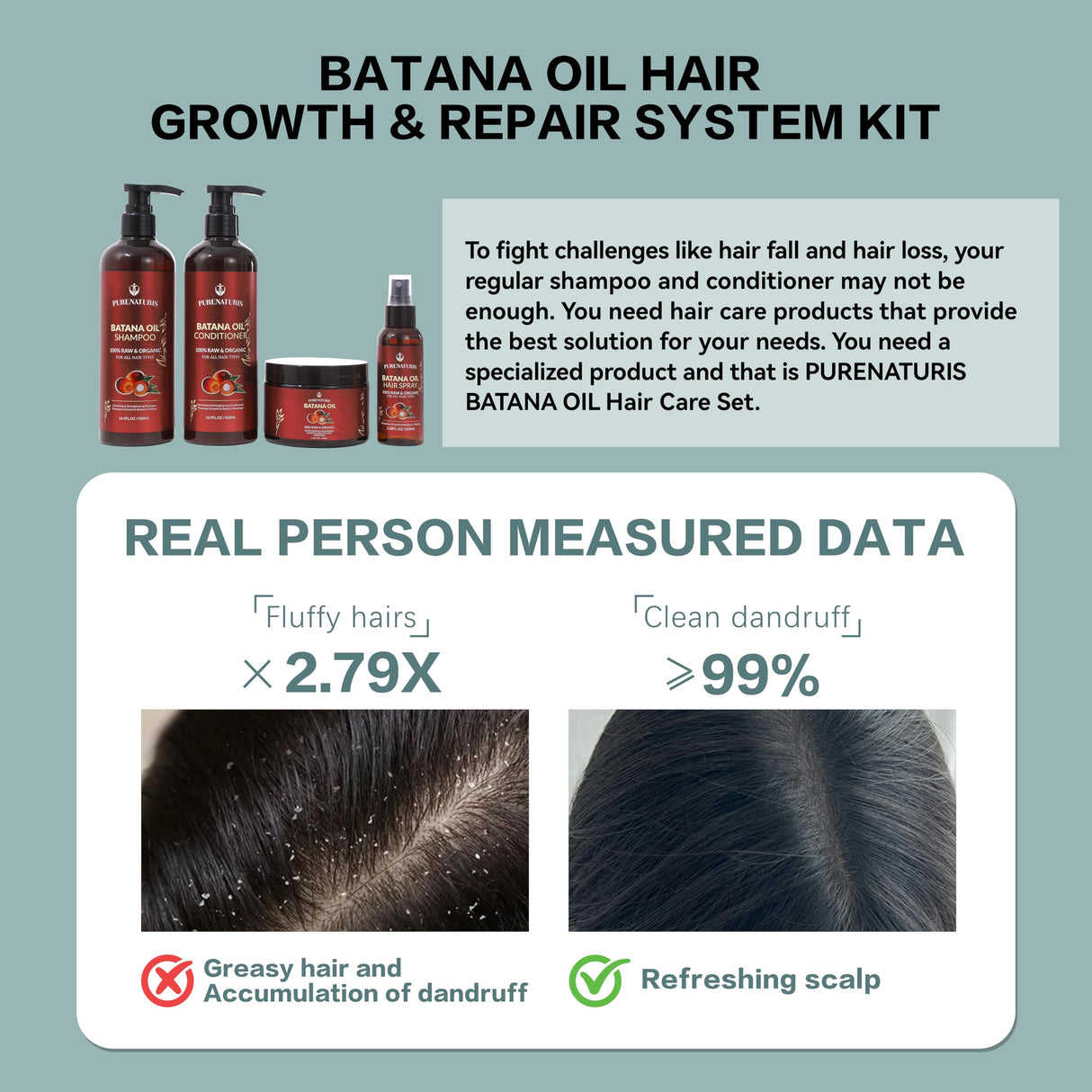 100% Natural Raw Organic Batana Oil Sulfate-Free Complete Hair Growth , Anti-Hair Loss & Repair System Kit – Shampoo, Conditioner, Hair Mask, & Leave-In Spray | Thickness & Prevents Loss for Men Women
