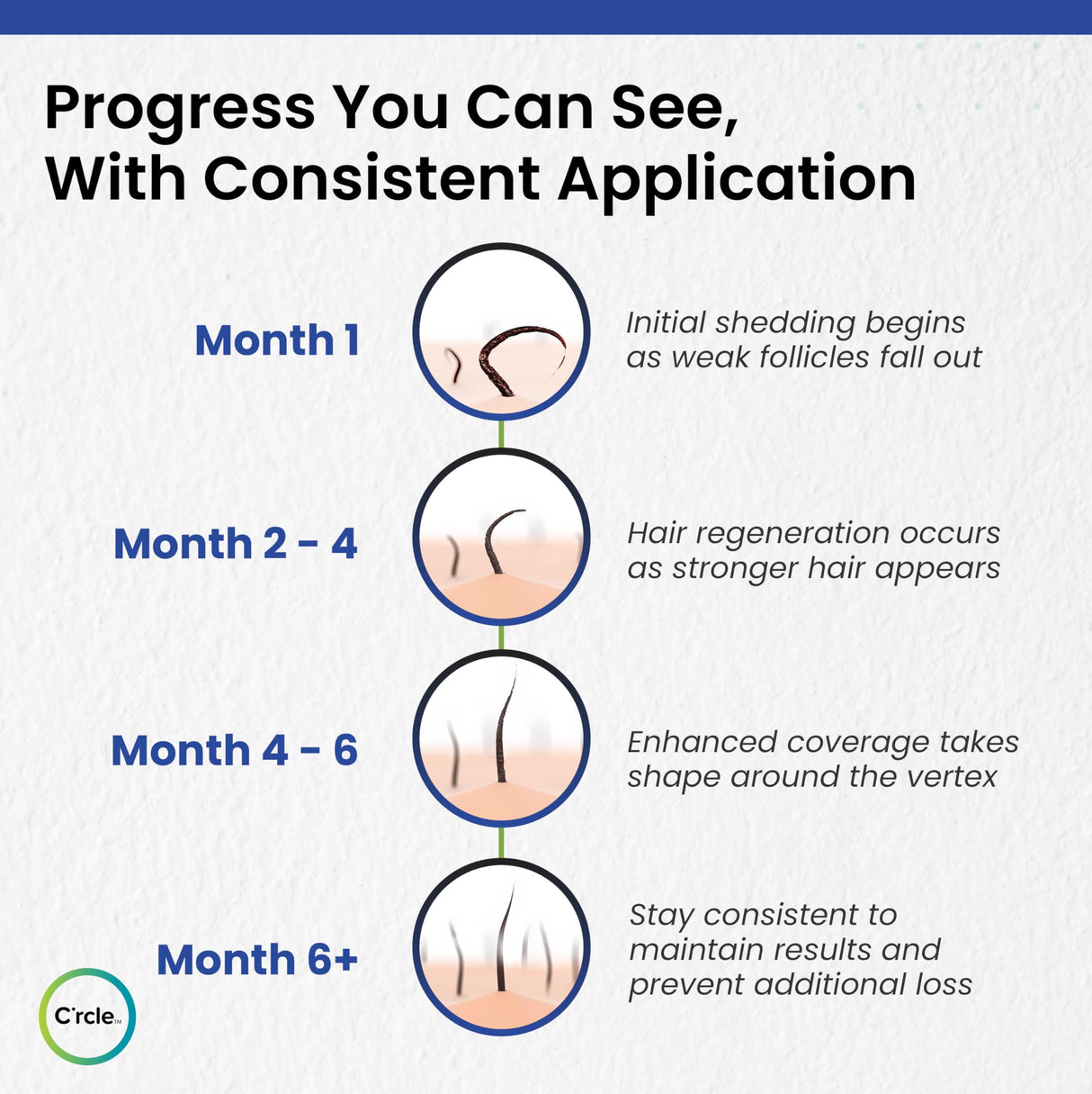C’rcle Men's Minoxidil 5% Foam - 6 Month Supply - Helps Restore Vertex Hair Loss & Thinning Hair - Extra Strength Supports Hair Regrowth for Men, Unscented Hair Loss Treatments for Men
