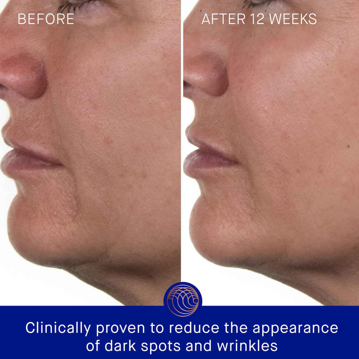 Augustinus Bader The Rich Cream 15ml