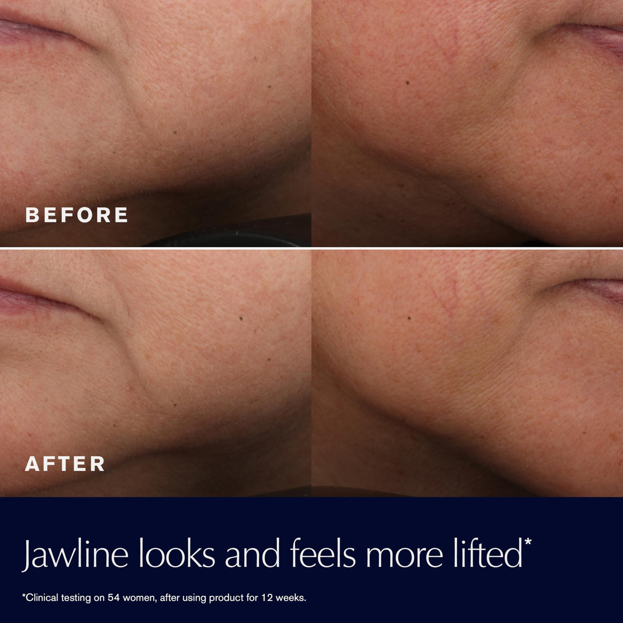 Estée Lauder Revitalizing Supreme+ Youth Power Cream Moisturizer with Hyaluronic Acid & Peptides, Anti Aging, 1.7 Ounce